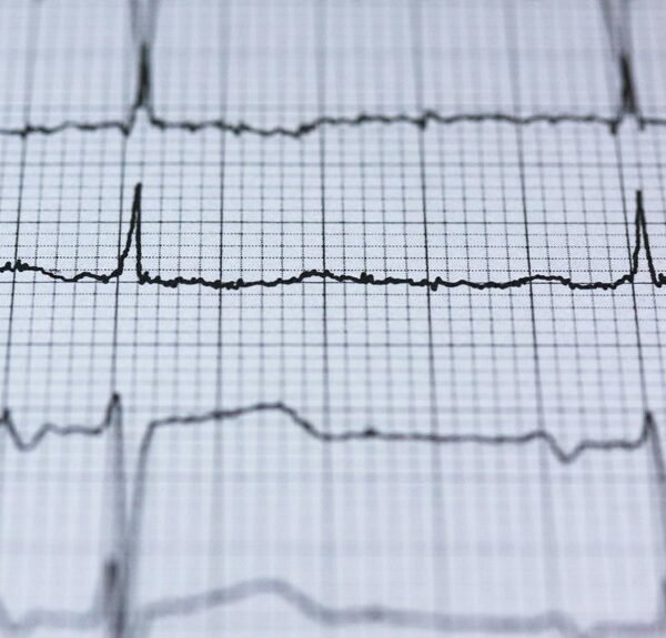 velocity edge growth pulse